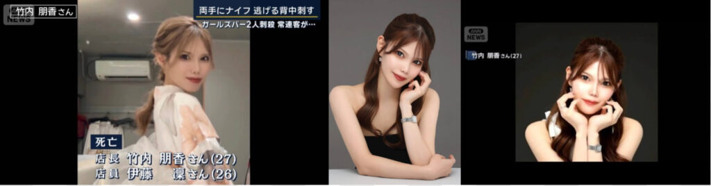 竹内朋香 整形 デマ